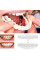 Съемные виниры Veneers, виниры для зубов, накладные зубы, накладки для зубов